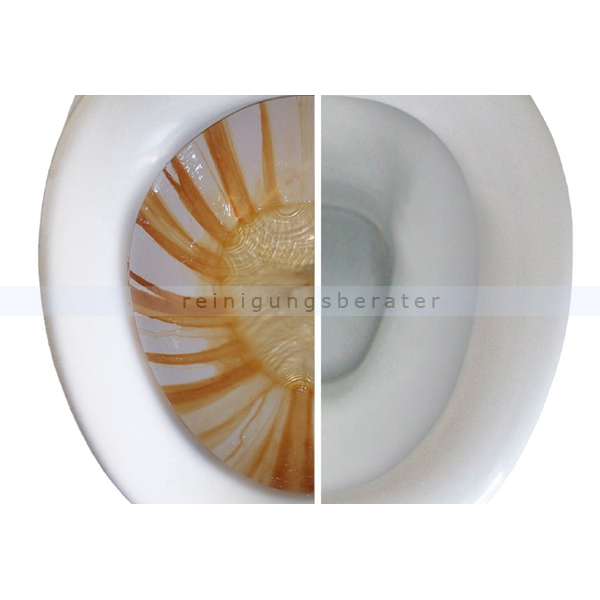 6 Stück WC Reinigungsstein Fleckenentferner Putzstein für Toiletten Porzellan 